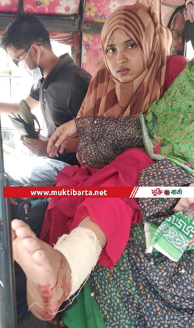 বানারীপাড়ায় শ্বশুর ও স্বামীর বিরুদ্ধে যৌতুকের দাবিতে গৃহবধুর পায়ের রগ কাটার অভিযোগ