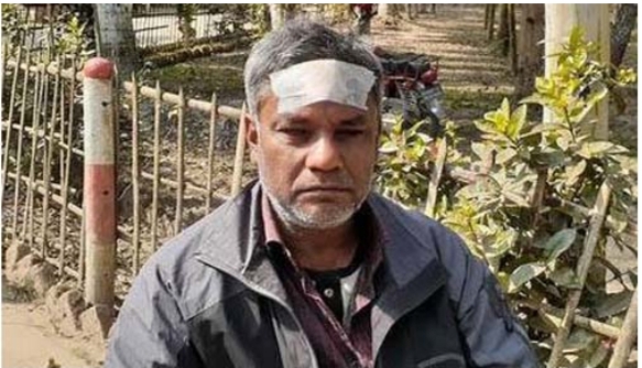 সরকারি হাই স্কুলের সিনিয়র শিক্ষক আমিনুল ইসলামকে পিটিয়েছে দূর্বৃত্তরা