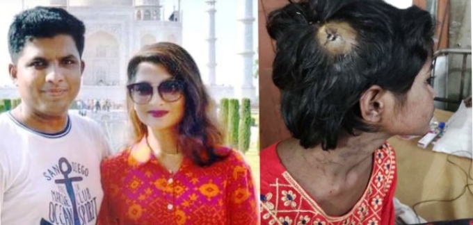 ঢাকায় চিকিৎসকের বাসায় উজিরপুরের শিশু গৃহকর্মীকে বর্বর নির্যাতন