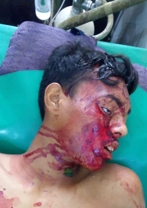 বানারীপাড়ায় ইটবোঝাই ট্রলি উল্টে হেলপার নিহত